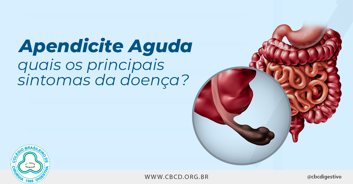 Apendicite aguda quais os principais sintomas da doença CBCD